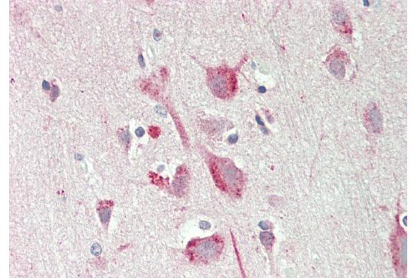 PSAT1 antibody  (N-Term)