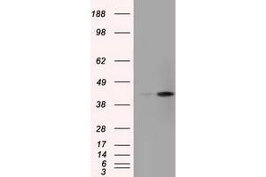 Image no. 6 for anti-Acetyl-CoA Acetyltransferase 2 (ACAT2) antibody (ABIN1496403) (ACAT2 antibody)