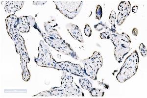 IHC analysis of splicing factor 1 using anti-splicing factor 1 antibody (ABIN7600193).