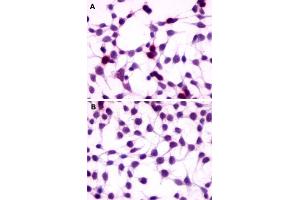 Immunocytochemistry (ICC) staining of HEK293 human embryonic kidney cells transfected (A) or untransfected (B) with GPRC5A. (GPRC5A antibody  (Extracellular Domain))