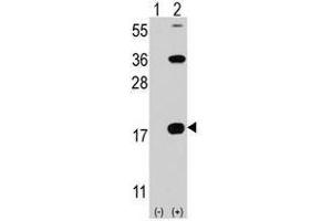 Image no. 1 for anti-CD247 Molecule (CD247) (C-Term) antibody (ABIN356886) (CD247 antibody  (C-Term))