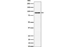 Western blot analysis of ACAP2 expression in 293 cell lysate. (Recombinant Centaurin beta 2 antibody)