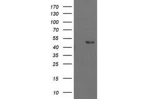 Western Blotting (WB) image for anti-Pre-B-Cell Leukemia Homeobox Protein 1 (PBX1) antibody (ABIN1500044) (PBX1 antibody)