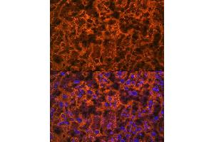 Immunofluorescence analysis of rat placenta using PLGF Rabbit mAb (ABIN7269384) at dilution of 1:100 (40x lens).