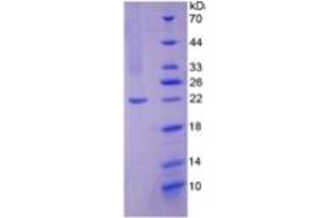 SDS-PAGE of Protein Standard from the Kit  (Highly purified E. (NOS2 ELISA Kit)