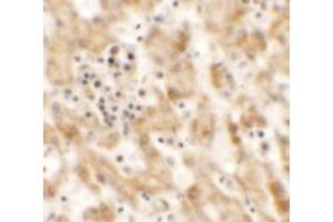 Immunohistochemistry of NKX2-8 in human liver tissue with NKX2-8 antibody at 2. (NKX2-8 antibody  (Middle Region))