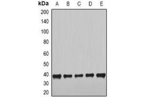 NudE Neurodevelopment Protein 1 (NDE1) antibody