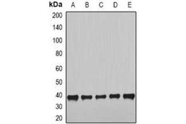 NudE Neurodevelopment Protein 1 (NDE1) antibody