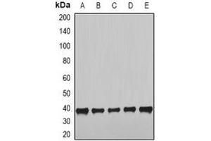 Western blot analysis of NUDE expression in HepG2 (A), SKOV3 (B), MCF7 (C), mouse heart (D), mouse lung (E) whole cell lysates.