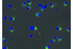Immunocytochemistry staining of normal human sperma with anti-PRKAR2A antibody (intracellular signal in acrosomes, green), DNA visualized by DAPI (blue). (PRKAR2A antibody)