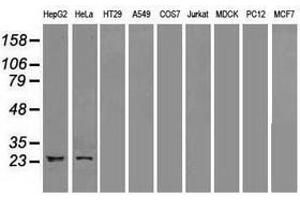 Image no. 1 for anti-Neurogenin 1 (NEUROG1) antibody (ABIN1499697) (Neurogenin 1 antibody)
