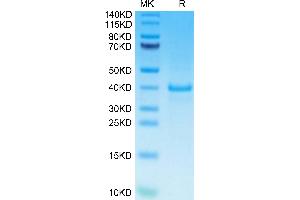 Human EGF on Tris-Bis PAGE under reduced condition. (EGF Protein (AA 971-1023) (Fc Tag))