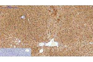Immunohistochemistry of paraffin-embedded Human liver tissue using HAO1 Monoclonal Antibody at dilution of 1:200. (HAO1 antibody)