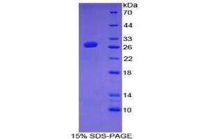 SDS-PAGE (SDS) image for Activating Transcription Factor 7 (AFT7) (AA 50-270) protein (His tag) (ABIN1879646) (AFT7 Protein (AA 50-270) (His tag))