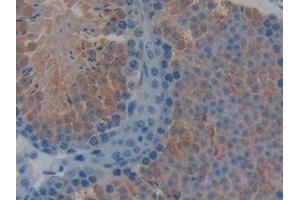 Immunohistochemistry (IHC) image for anti-Torsin Family 1, Member B (Torsin B) (TOR1B) (AA 83-327) antibody (ABIN5014427)