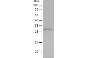 Western Blotting (WB) image for Endonuclease VIII-Like 1 (NEIL1) (AA 200-390) protein (His tag) (ABIN7122772) (NEIL1 Protein (AA 200-390) (His tag))
