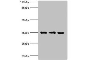 Western blot All lanes: Rab effector Noc2 antibody at 2 μg/mL Lane 1: Rat liver tissue Lane 2: K562 whole cell lysate Lane 3: A549 whole cell lysate Secondary Goat polyclonal to rabbit IgG at 1/10000 dilution Predicted band size: 35, 32 kDa Observed band size: 35 kDa (RPH3AL antibody  (AA 1-315))
