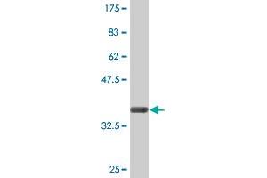 Western Blot detection against Immunogen (36. (CLCN7 antibody  (AA 706-805))