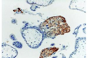 Immunohistochemistry staining with anti-human HLA-G (MEM-G/1). (HLAG antibody  (Biotin))