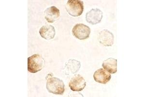 Immunocytochemistry staining of HeLa cells using AP30406PU-N IKK beta antibody at 10 μg/ml.