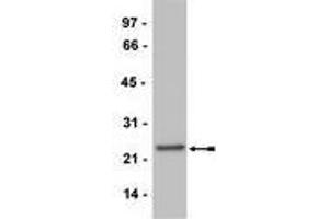 Western Blotting (WB) image for anti-CD3 (CD3) (Activation Site) antibody (ABIN400888) (CD3 antibody  (Activation Site))