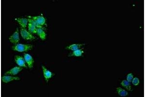 Immunofluorescent analysis of HepG2 cells using ABIN7159916 at dilution of 1:100 and Alexa Fluor 488-congugated AffiniPure Goat Anti-Rabbit IgG(H+L) (TOMM2 (AA 20-145) antibody)