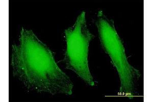Immunofluorescence of purified MaxPab antibody to FANCA on HeLa cell. (FANCA antibody  (AA 1-297))
