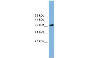 WB Suggested Anti-GRIPAP1 Antibody Titration: 0. (GRIPAP1 antibody  (N-Term))