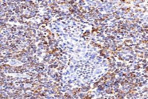 Immunohistochemistry analysis of paraffin-embedded human tonsil using,HLA-DP (ABIN7074613) at dilution of 1: 2400 (HLA-DP antibody)
