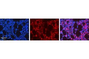 Rabbit Anti-ADRBK1 Antibody Catalog Number: ARP51965_P050 Formalin Fixed Paraffin Embedded Tissue: Human Bone Marrow Tissue Observed Staining: Cytoplasm, Plasma membrane Primary Antibody Concentration: 1:600 Other Working Concentrations: N/A Secondary Antibody: Donkey anti-Rabbit-Cy3 Secondary Antibody Concentration: 1:200 Magnification: 20X Exposure Time: 0. (GRK2 antibody  (N-Term))