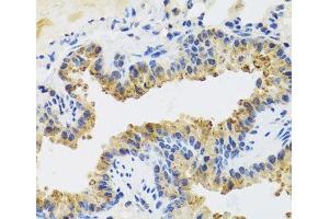Immunohistochemistry of paraffin-embedded Mouse lung using UVRAG Polyclonal Antibody at dilution of 1:100 (40x lens). (UVRAG antibody)