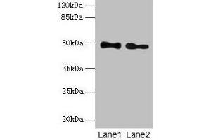 Western blot All lanes: ABHD2 antibody at 10 μg/mL Lane 1: Mouse heart tissue Lane 2: Rat gonadal tissue Secondary Goat polyclonal to rabbit IgG at 1/10000 dilution Predicted band size: 49 kDa Observed band size: 49 kDa