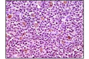 Immunohistochemistry (IHC) image for anti-Induced Myeloid Leukemia Cell Differentiation Protein Mcl-1 (MCL1) antibody (ABIN1108171) (MCL-1 antibody)