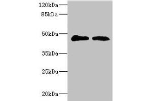 Western blot All lanes: GCNT2 antibody at 3. (GCNT2 antibody  (AA 203-402))