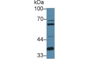 Rabbit Capture antibody from the kit in WB with Positive Control: Sample Human hela cell lysate. (FURIN ELISA Kit)