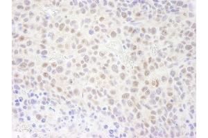 Immunohistochemistry (IHC) image for anti-Replication Protein A1, 70kDa (RPA1) (AA 350-400) antibody (ABIN7448781) (RPA1 antibody  (AA 350-400))