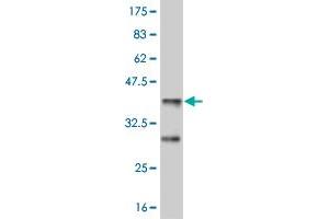 Western Blot detection against Immunogen (36. (MEF2D antibody  (AA 256-351))