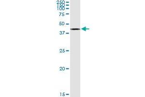 ACAT2 MaxPab rabbit polyclonal antibody. (ACAT2 antibody  (AA 1-397))