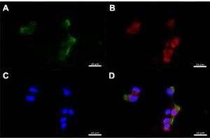 Immunofluorescent staining of human nasal epithelial cells with CD151 polyclonal antibody  at 1:100 dilution. (CD151 antibody  (C-Term))