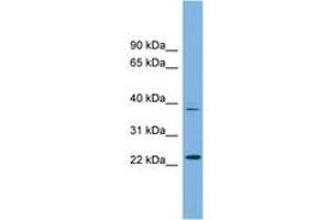 Image no. 1 for anti-Transcription Factor Dp Family, Member 3 (TFDP3) (AA 71-120) antibody (ABIN6745240) (TFDP3 antibody  (AA 71-120))