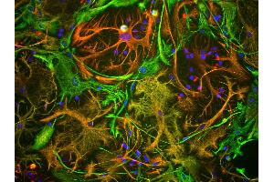 View of mixed neuron/glial cultures stained with vimentin antibody (green) and rabbit antibody to GFAP antibody (red).
