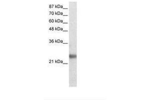 Image no. 1 for anti-Ring Finger Protein 114 (RNF114) (AA 77-126) antibody (ABIN202094) (RNF114 antibody  (AA 77-126))