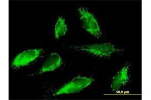 Immunofluorescence of purified MaxPab antibody to SCO1 on HepG2 cell. (SCO1 antibody  (AA 1-301))
