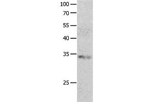 Western Blotting (WB) image for anti-RNA Binding Protein, Fox-1 Homolog 3 (RBFOX3) antibody (ABIN2426281) (NeuN antibody)