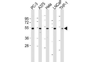 Western Blotting (WB) image for anti-Nuclear Factor of kappa Light Polypeptide Gene Enhancer in B-Cells Inhibitor, epsilon (NFKBIE) (AA 109-141), (N-Term) antibody (ABIN6243240)
