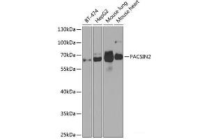 Western blot analysis of extracts of various cell lines using PACSIN2 Polyclonal Antibody at dilution of 1:1000. (PACSIN2 antibody)