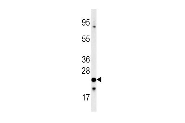 Frataxin antibody  (C-Term)