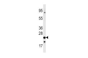 Western blot analysis of anti-FXN Antibody (C-term) (ABIN390377 and ABIN2840779) in 293 cell line lysates (35 μg/lane). (Frataxin antibody  (C-Term))