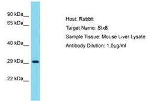Image no. 1 for anti-Syntaxin 8 (STX8) (AA 161-210) antibody (ABIN6750455) (STX8 antibody  (AA 161-210))