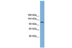 WB Suggested Anti-Myt1 Antibody Titration: 0. (MYT1 antibody  (N-Term))